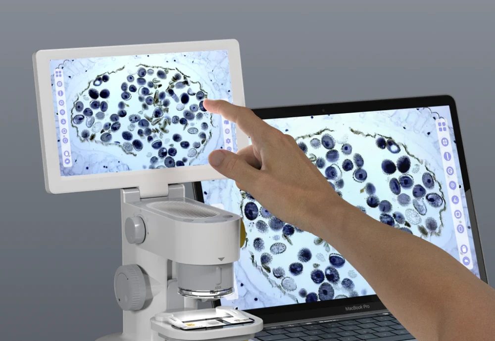 best digital microscope with screen